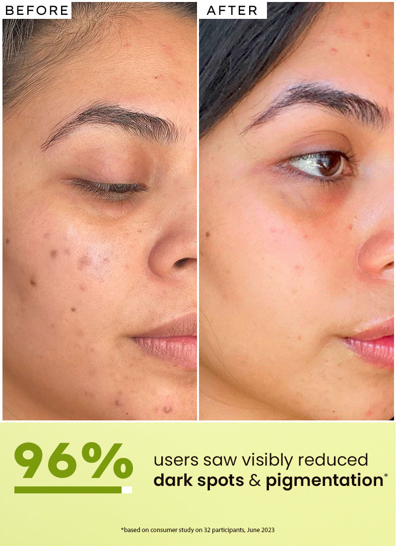 Golden Hour Glow Serum | 5% niacinamide, 1% alpha arbutin & 25% kakadu plum